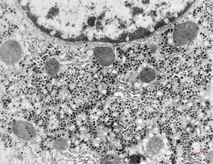 M,19y. | normal hepatocyte